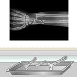 Operate Now: Arm Surgery